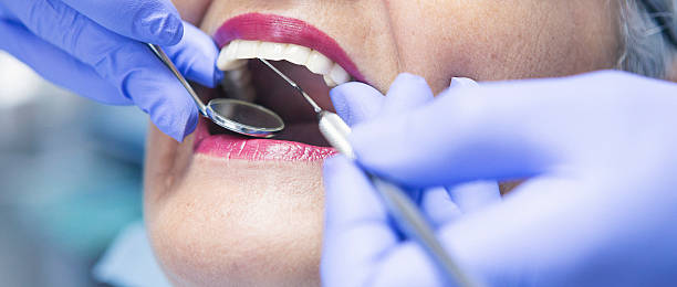 Best Emergency Broken Tooth Repair in La Follette, TN